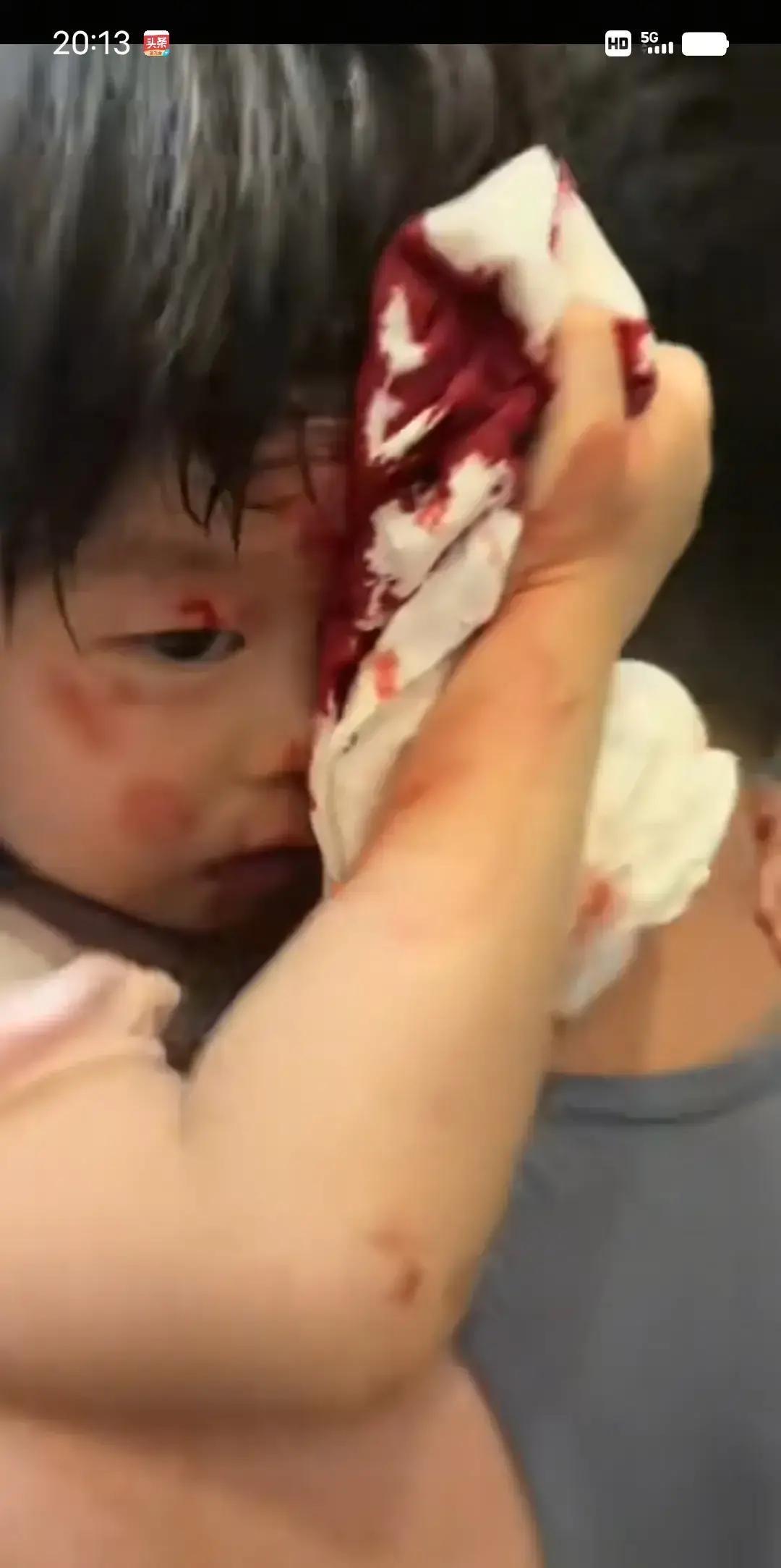 奶奶把孙女推到茶几缝了四针，就因为一句饭难吃。监控里老人突然冲过去，孩子后仰磕