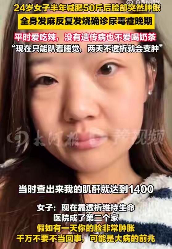 24岁女子半年暴增58斤，又减肥50斤后确诊尿毒症：以为脸肿是又吃胖了，现在靠透