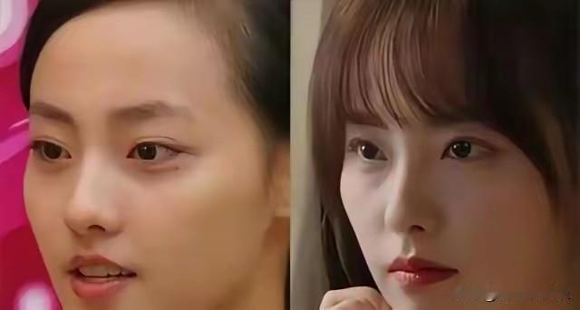 沉寂两年复出的张嘉倪脸大变样，薄唇变成了嘟嘟唇，之前白皙的皮肤变得十分暗黄，“