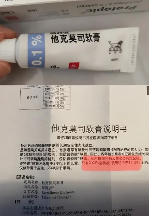 白癜风别瞎用他克莫司，‼️这些要点必看