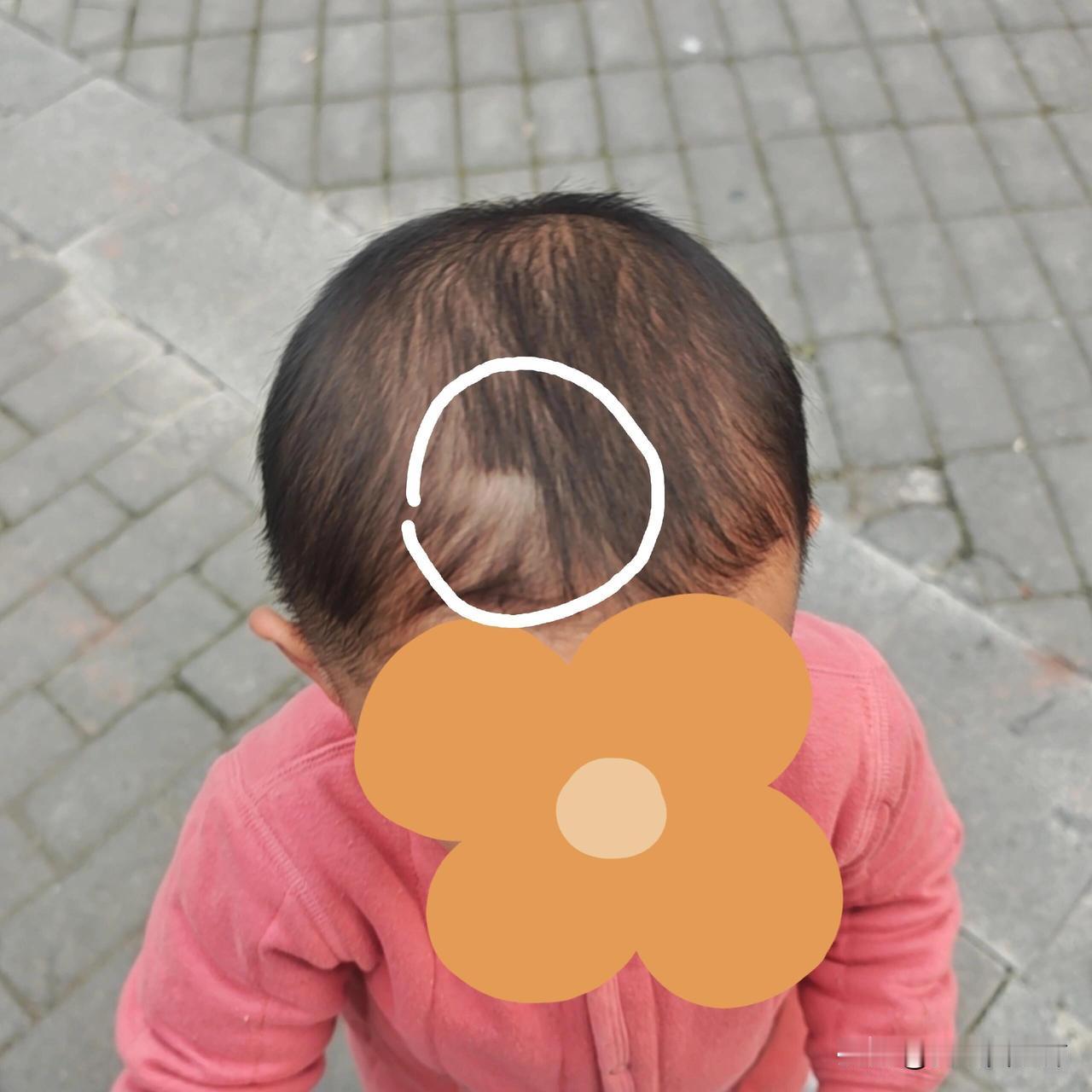 上幼儿园头发被老师剪了正常吗？家里是龙凤胎，宝宝今年三岁，今年3.1号开始读的