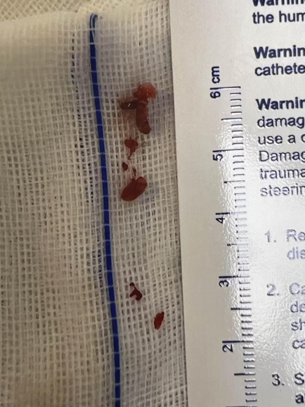 刚从医院回来，不得不提醒一下家有高龄老人的朋友，在天气突然降温的时候，要比平常更