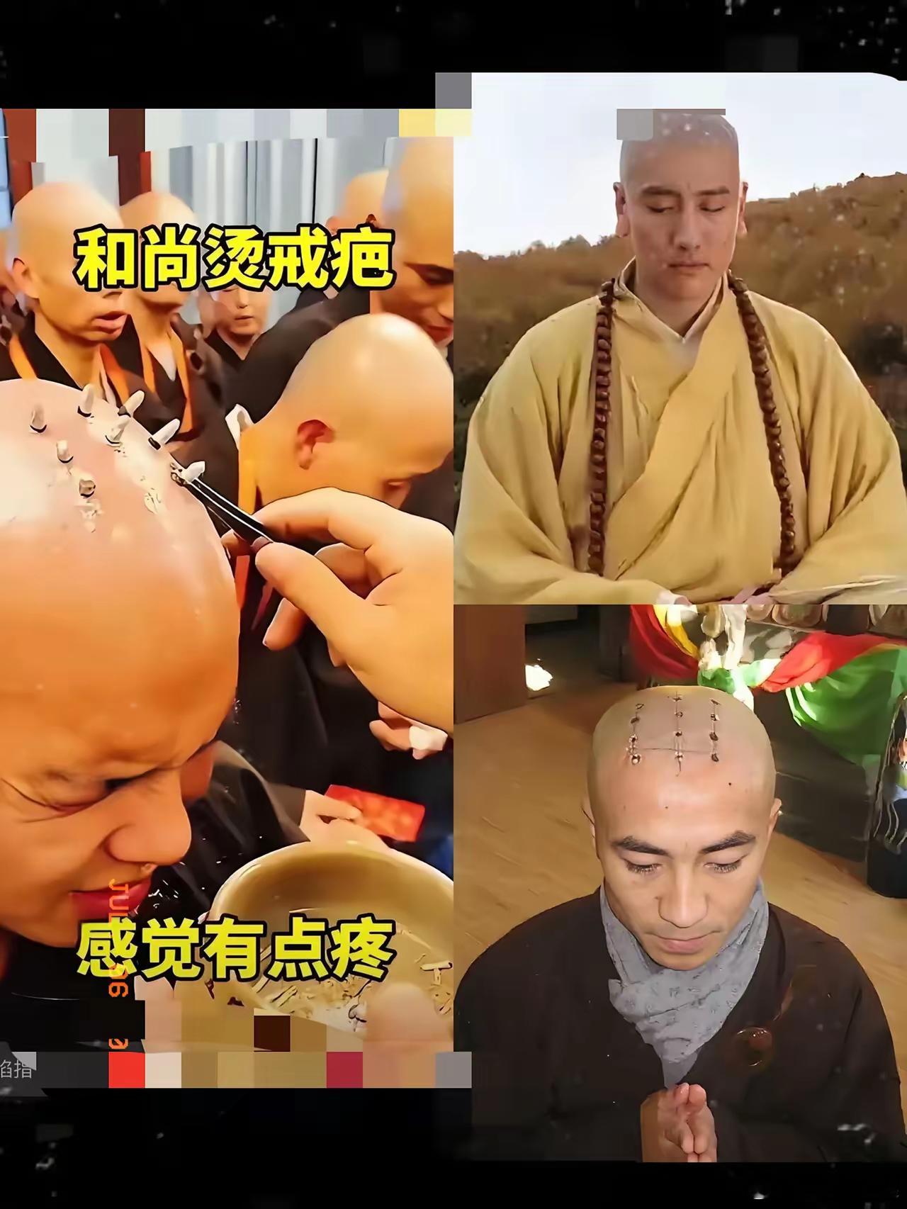 来自基层的呼声火了：​强烈建议佛教恢复戒疤！​这事儿可不简单，​​戒疤在很多人眼