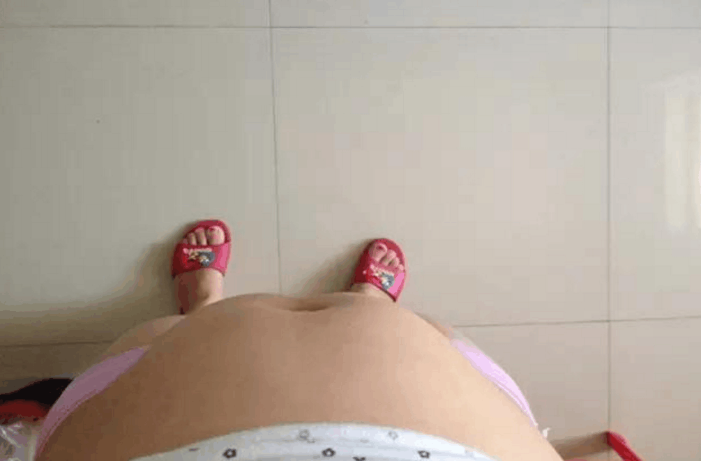 28岁孕妇三个月肚子大得出奇, 医院检查后告知结果, 老公听后哭笑不得