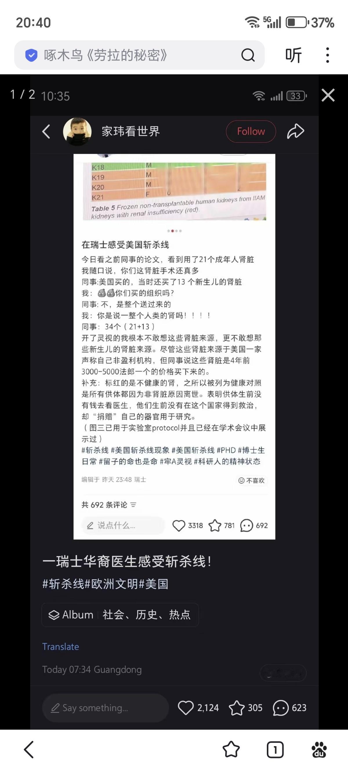 瑞士一名中国医学生曝光了实验室里的34个人体肾脏——21个成人，13个新生儿。这