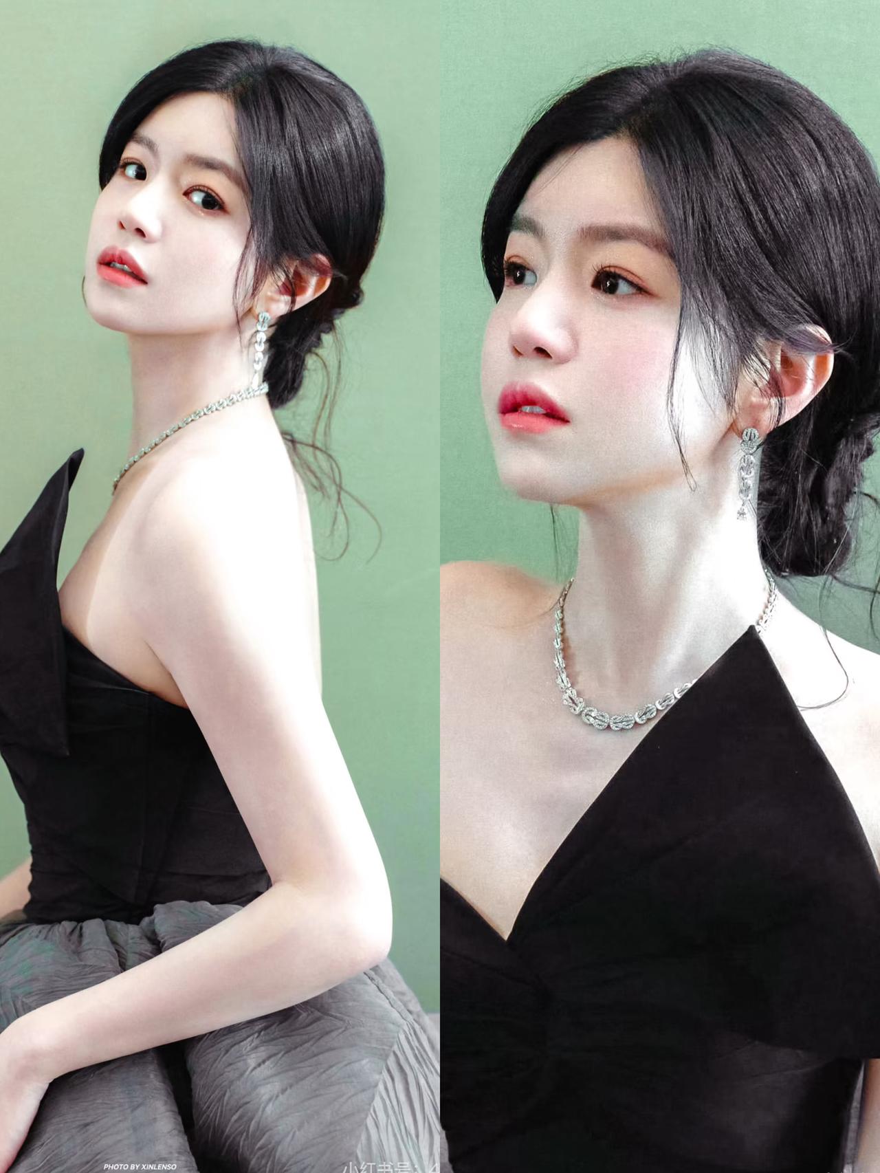 我有一个发小是医院骨科的医生，​她告诉我一个真相，​像陈妍希这次训练导致