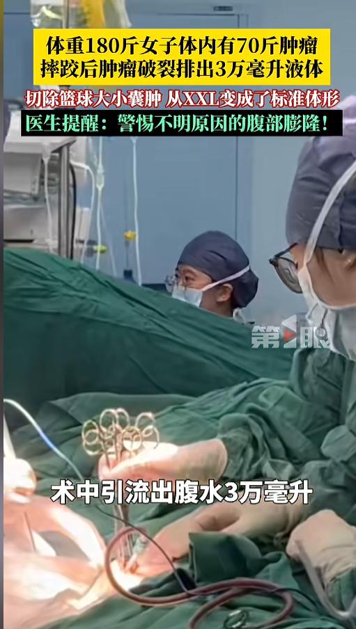 5月11日报道，浙江，一女子体重180多斤，肚子很大，一直致力于减肥，却始终没能