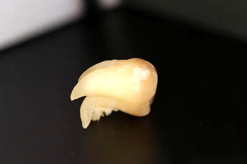 你敢信吗？咱们每个人的牙床上，其实都憋着第三副新牙！对，就是现在，就在你嘴里。