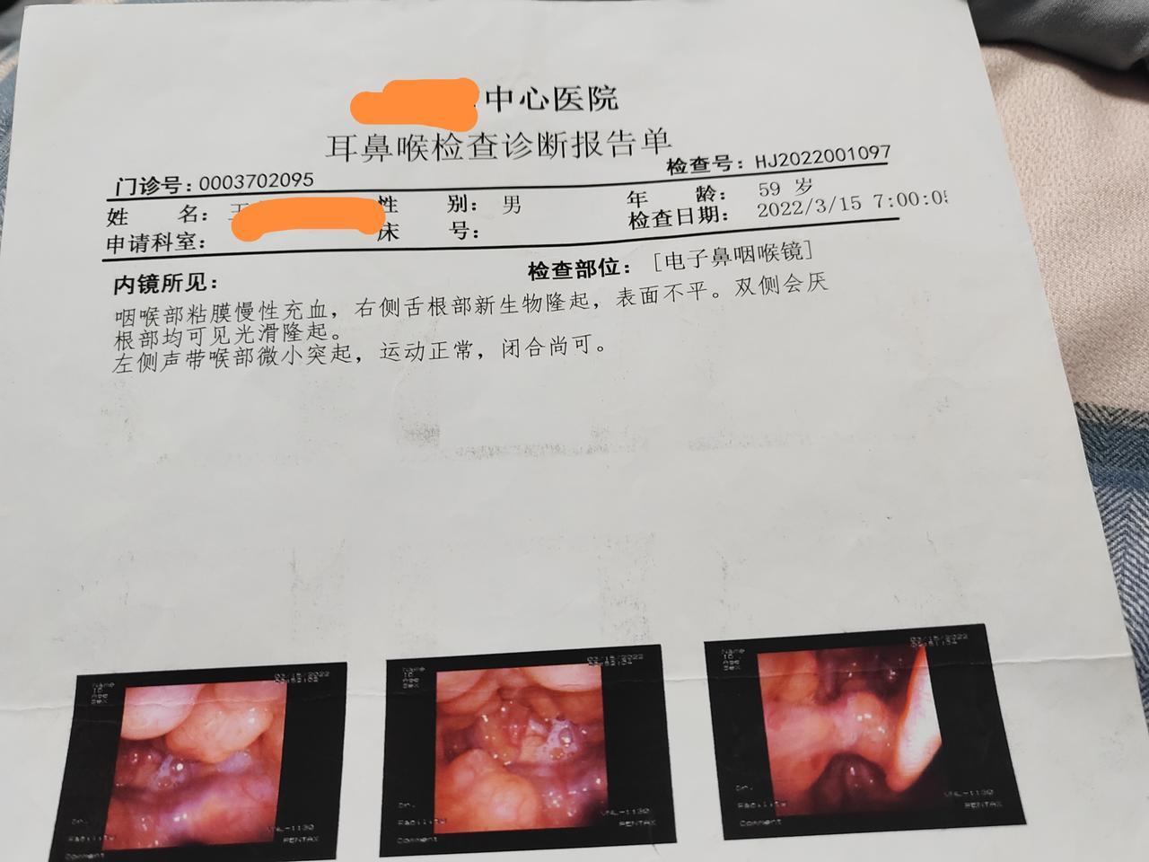 医生说什么，自己还是要点主见。我2021年，。咽喉总感不适。在本地医生看了，说是