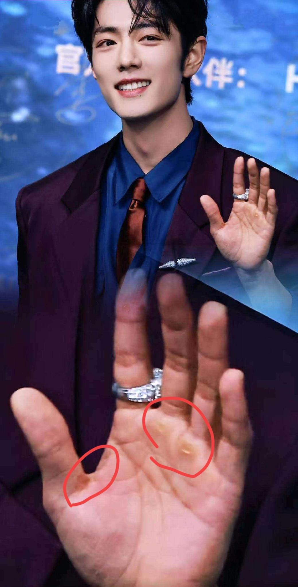 你可以说我肤浅，也可以说我没见识，但我是真的不敢相信，帅气的肖战，他的手