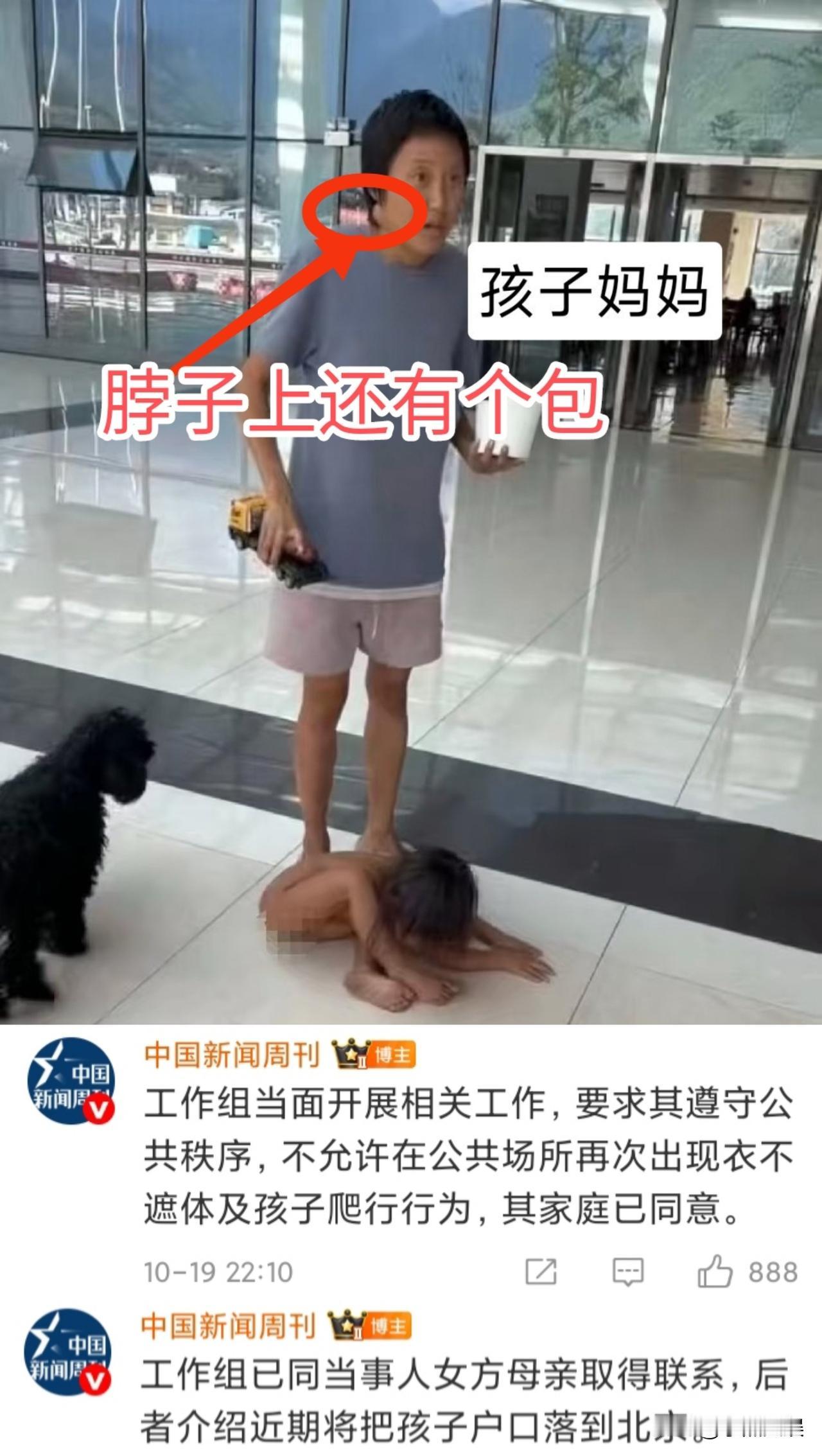 野人小孩父母同意孩子落户北京。路人拍到孩子母亲，看起来邋里邋遢的精神状态存疑，