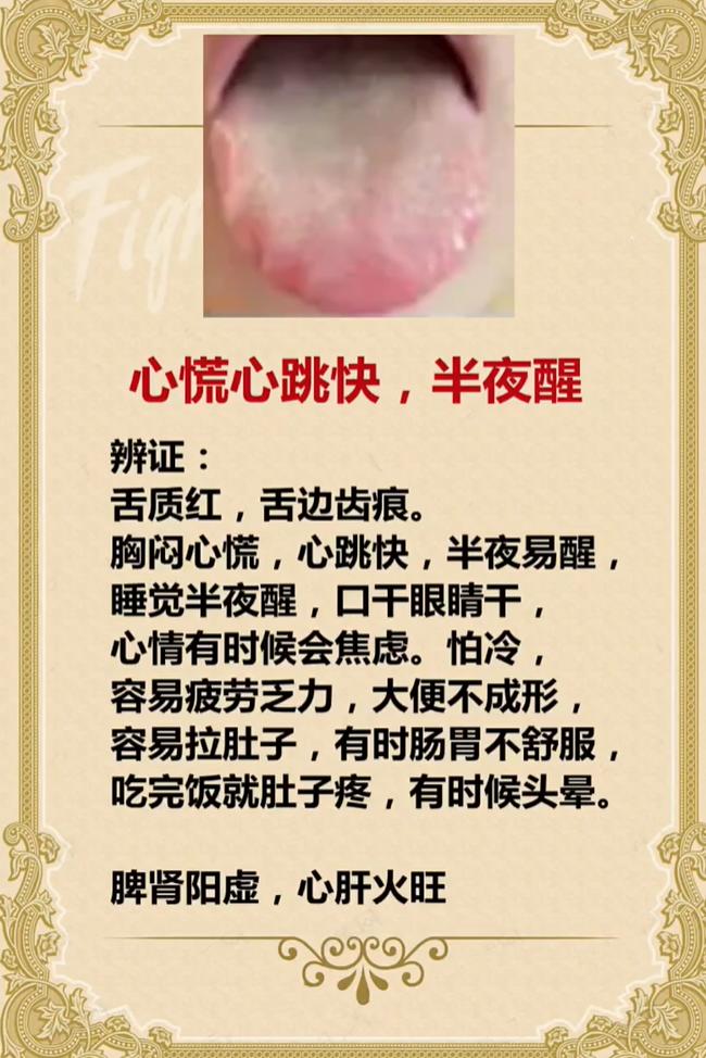 舌质红有齿痕、心慌失眠，中医辨证多为脾肾阳虚、心肝火旺