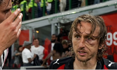 AC米兰中场，40岁克罗地亚国脚莫德里奇，上轮联赛与尤文中场洛卡特利头部相撞。赛