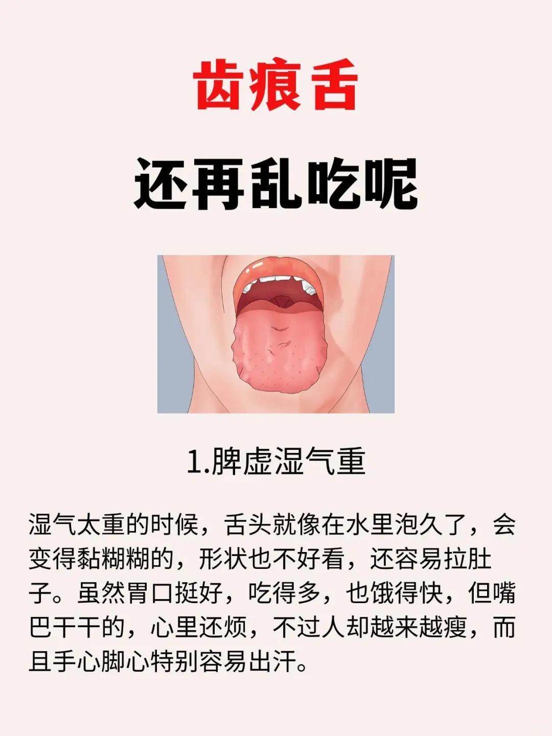 舌头上有齿痕？别再随便补了！