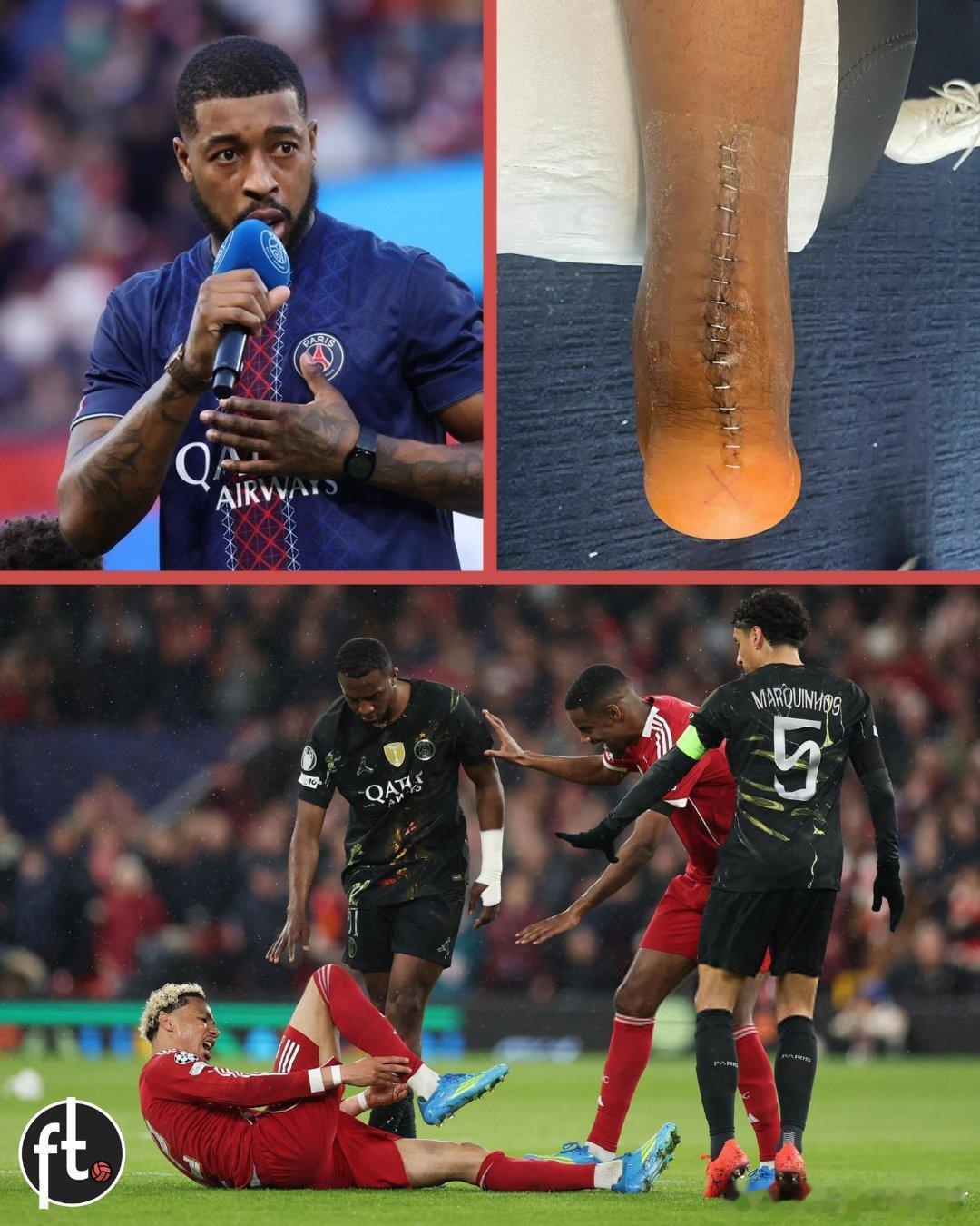 埃基蒂克的跟腱断裂伤，可能是足球界最难恢复的伤病之一。这种伤痛苦异常，恢复期漫长