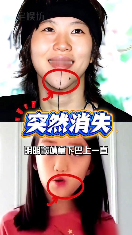 别再说窦靖童的下巴纹身是为了妹妹了，你只猜对了一半。李嫣天生唇腭裂，从小活在