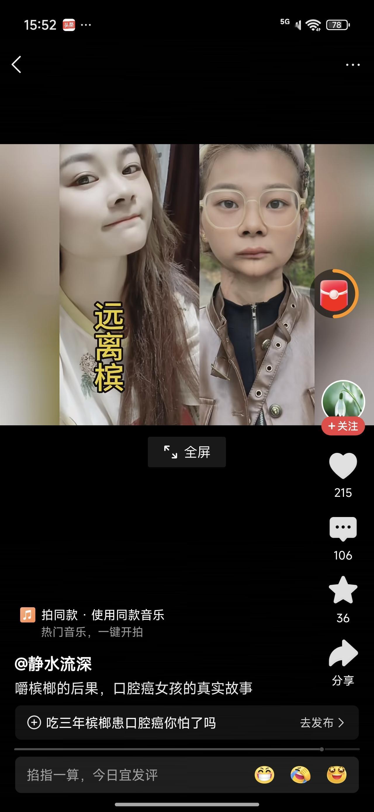 吃槟榔吃成这样子，太惨了。她说有时候吃一两包，有时候吃七八包，一天。这个东西大