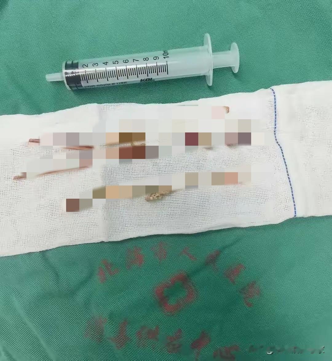 这大哥对自己是真狠！20年啊！刷到这个新闻真是服了，刷新三观广东一男子就