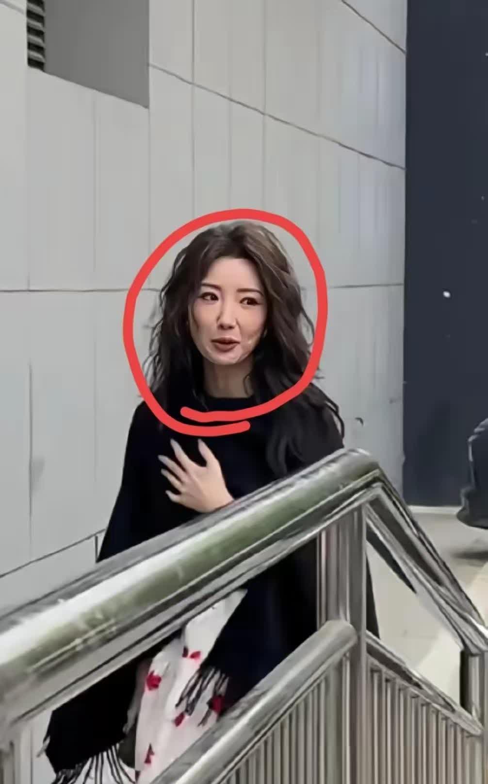 真搞不懂毛晓彤，明明这么漂亮了，还要去做医美，现在岁数大了后遗症紧随着就来了，比