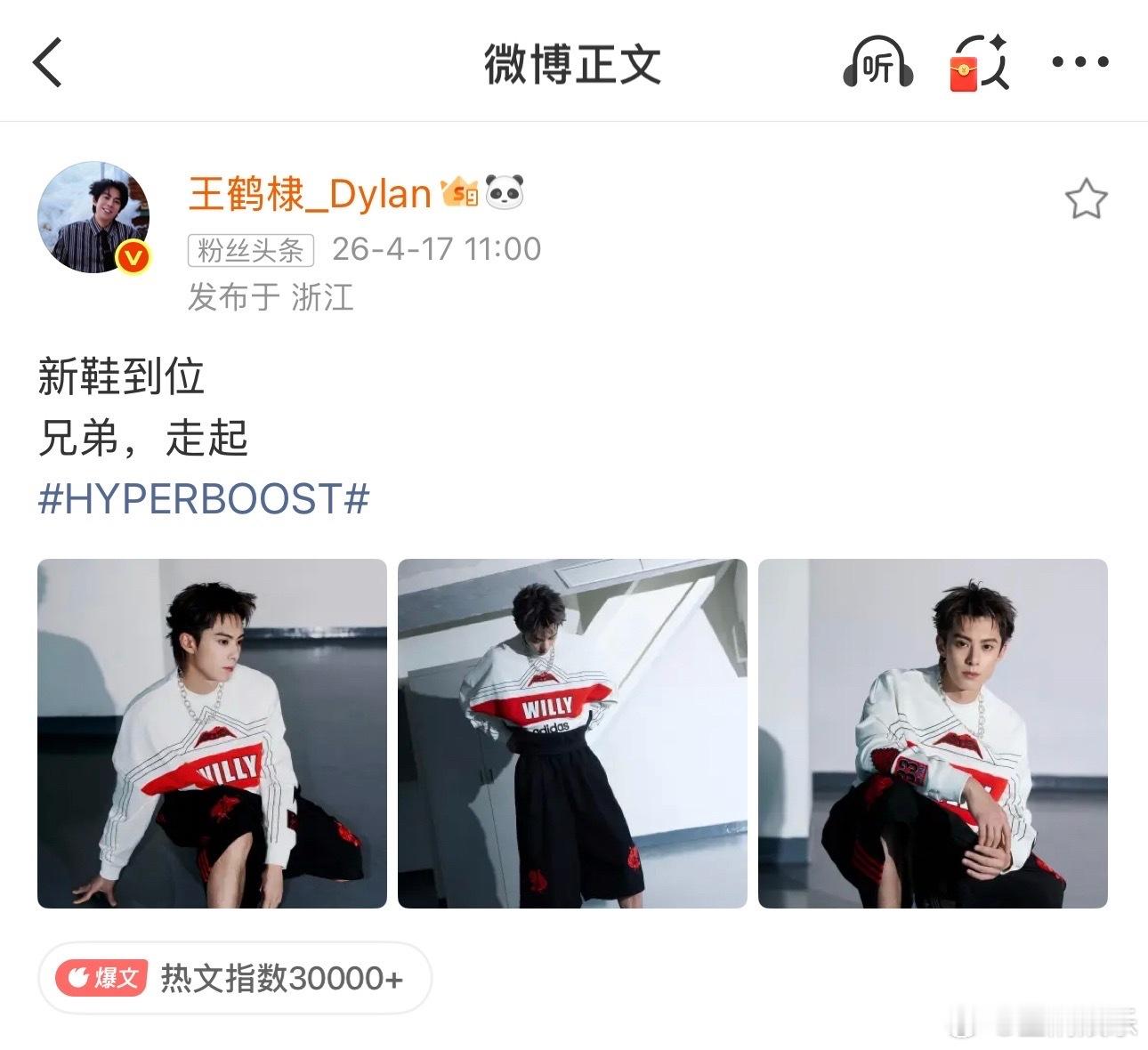 王鹤棣的新鞋很有特色啊