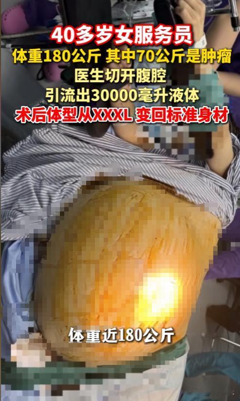 真是活久见！浙江40多岁女服务员，1米56的个子，180斤的体重，十几年减肥减