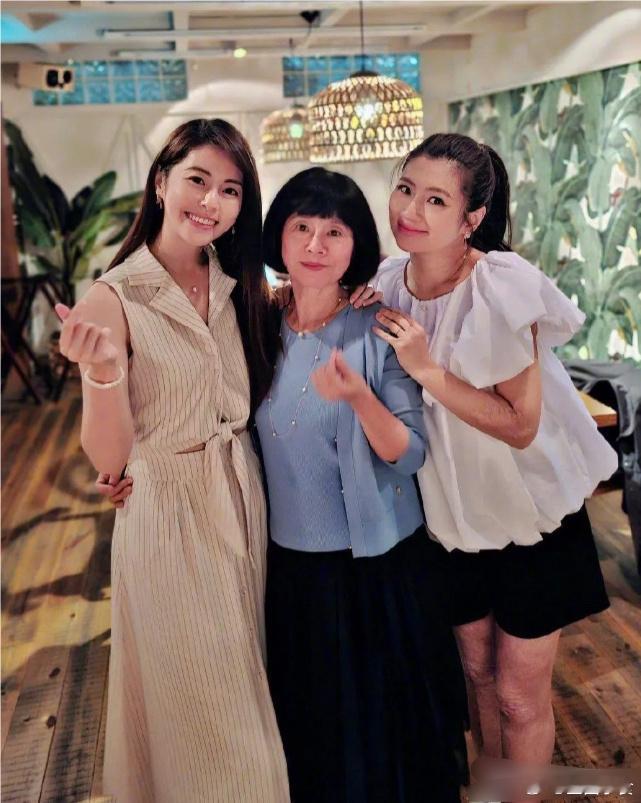 任家萱露腿了，可以看得出烧伤很厉害，整个腿上坑坑洼洼，真的有勇气