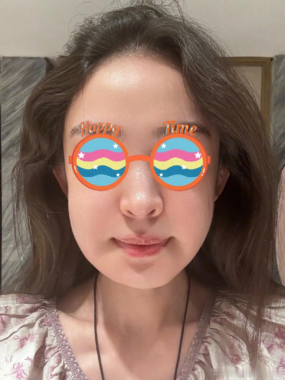 古力娜扎牙龈肿成方脸了哈哈哈哈哈哈，蜜蜂狗本人了​​​