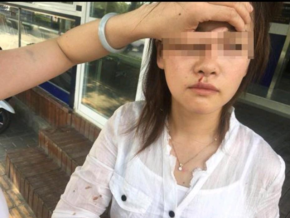 她吐了出租车司机一口唾沫！因为超载引发的互殴事件，究其核心，也不过是，鹿女士觉
