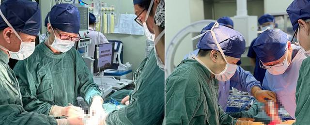 11岁男孩患恶性肿瘤, 上海医生借助3D打印“毫米级定位”精准切除