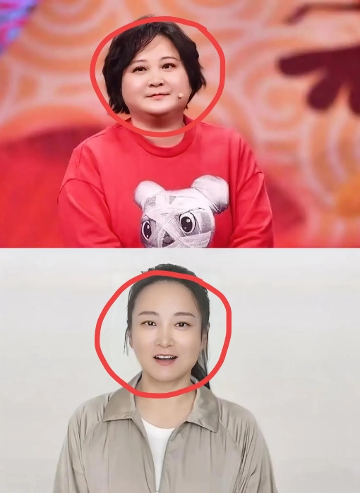 终于知道为什么贾玲减重100斤不仅没有掉头发，还越来越漂亮了不是因为医美