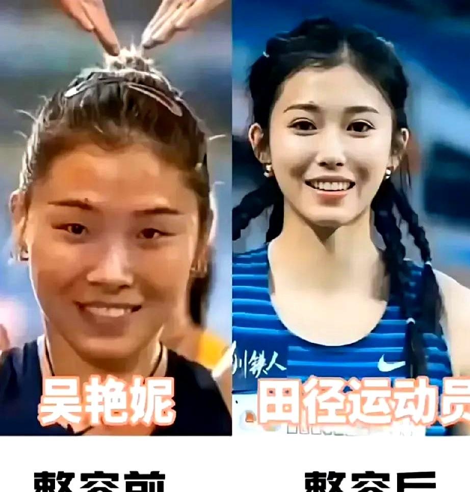 整容前的田志希。整容前的杜丽。整容前的郎平。整容前的吴艳妮。这些运动员们，她们都