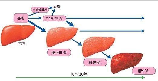 【冬季养生健康生活】有这症状要注意了, 看看你的肝是否......