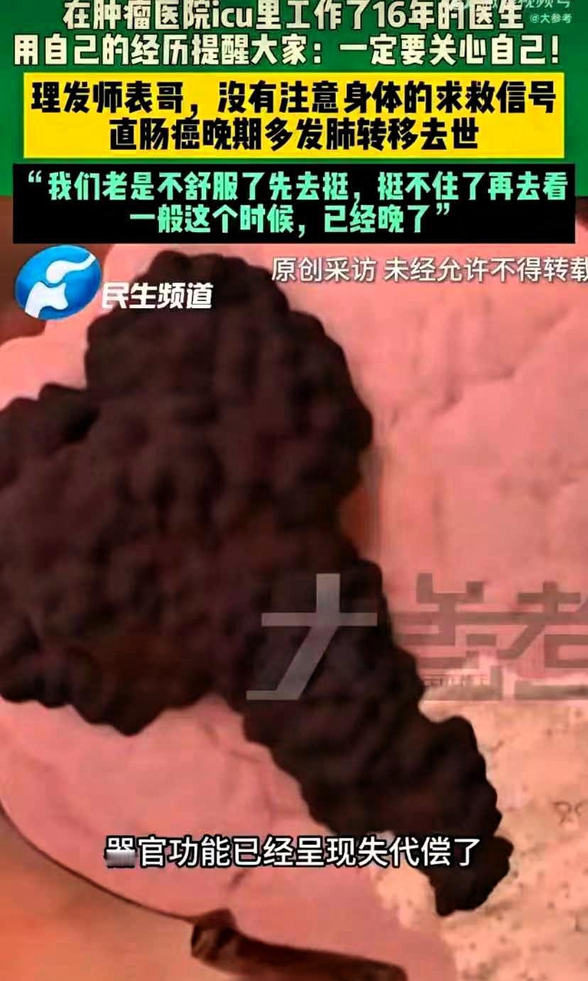 我跟你讲个真事，挺揪心的。郑州肿瘤医院有位贾医生，在ICU干了十六年，他反复提醒