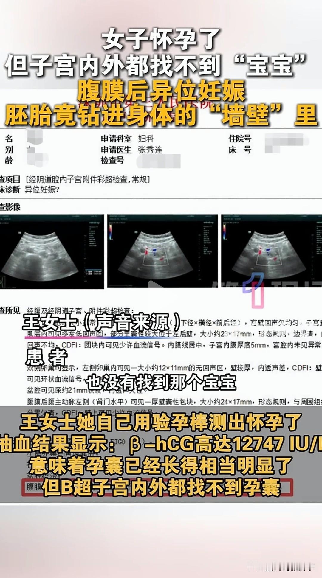女子确认怀孕后做B超，医生拿着探头找了一遍又一遍，子宫里空空如也，宫外也毫无踪迹