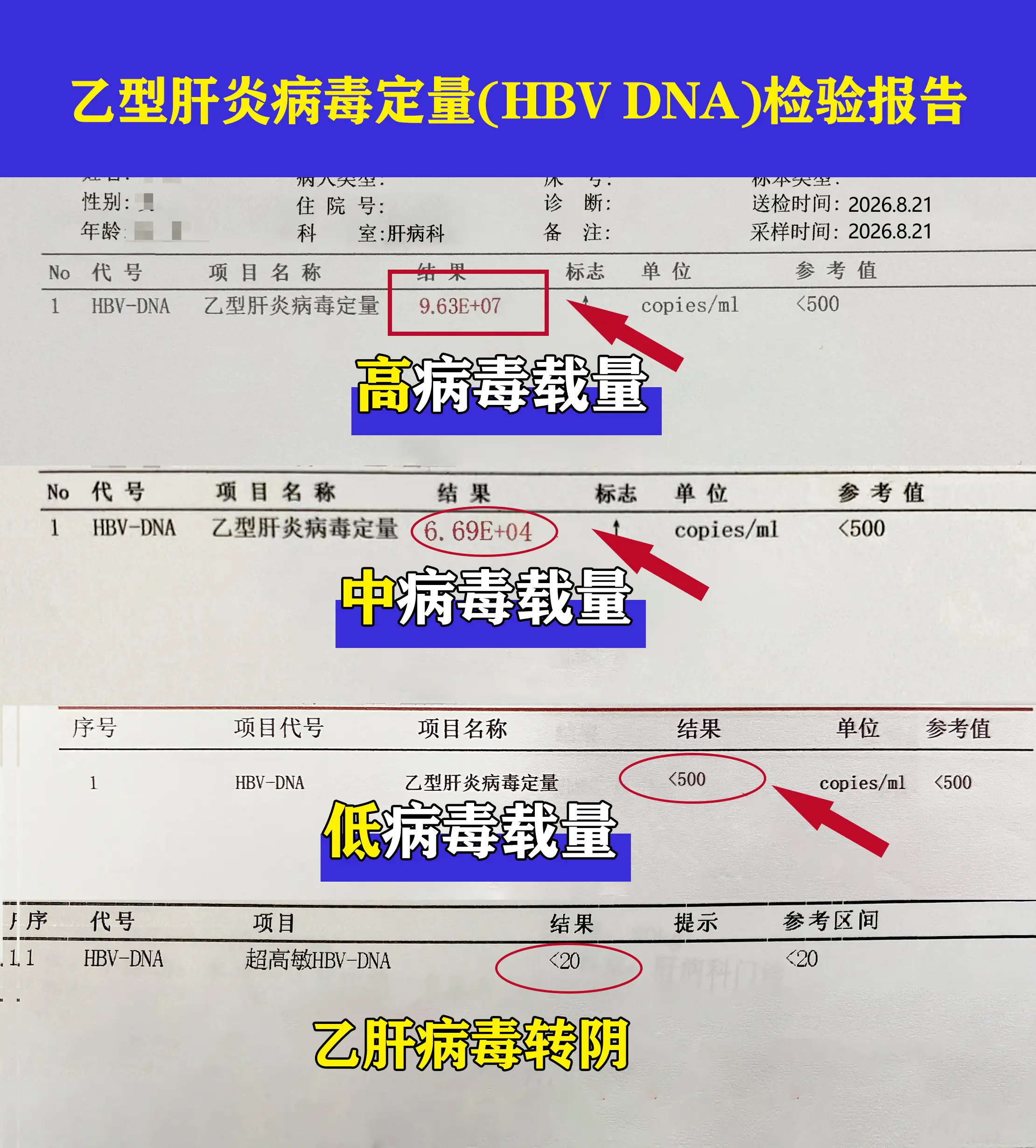 开学季不少朋友趁着假期尾声赶来复查，最近评论区很多人发来乙肝病毒定量报...