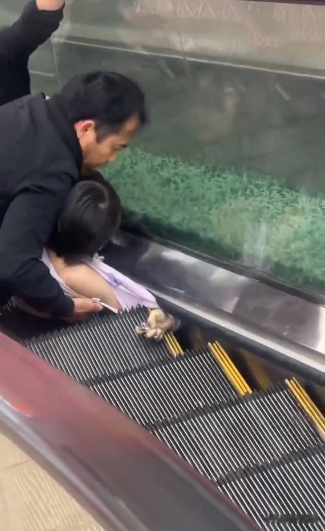 太惨了，孩子乘坐商场自动扶梯，手被电梯夹住。看那只已经变乌，没有一点血色的手掌