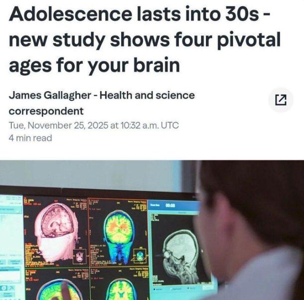 【一项新研究发现，“青少年大脑”会一直存在于我们体内直到30岁——而我们真正开始