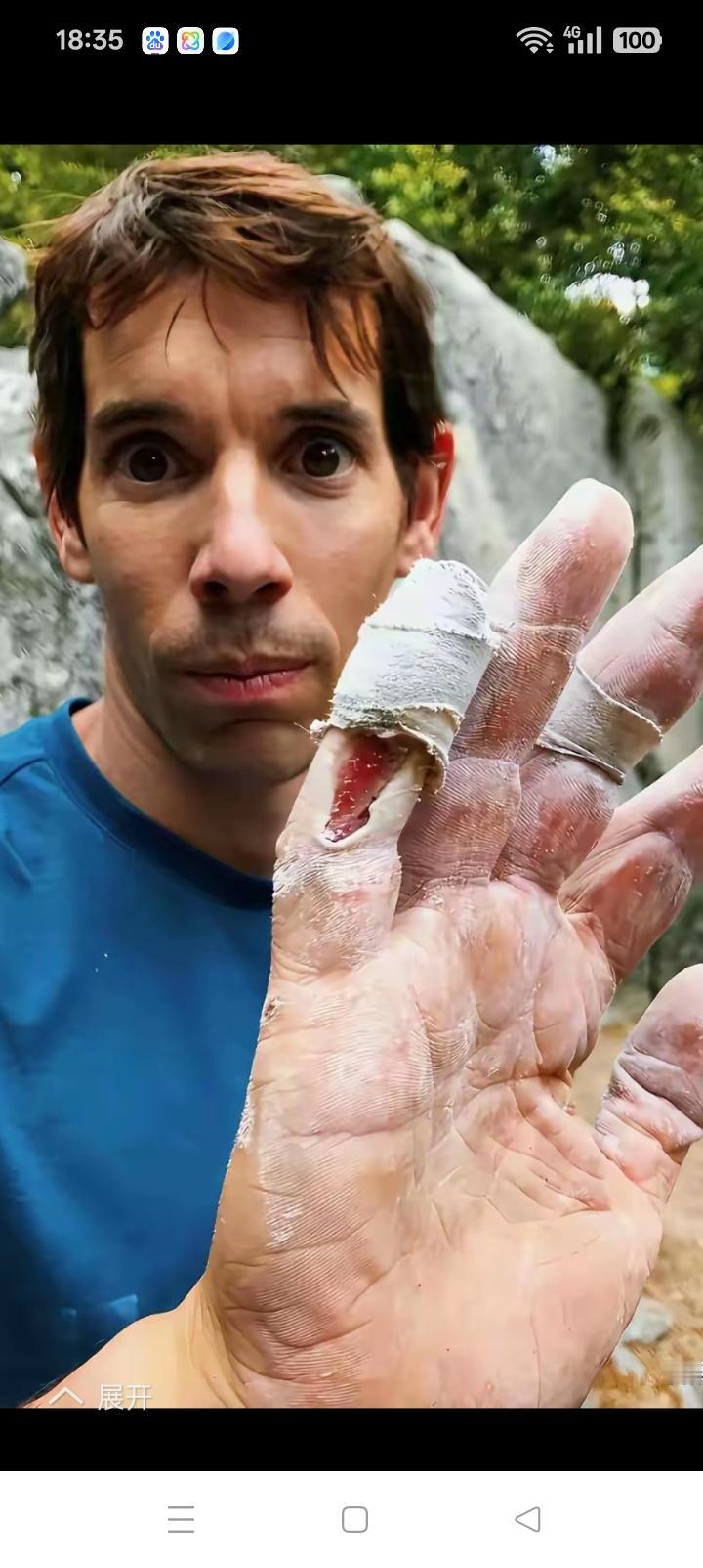 一个半小时赚1000万台币，看看艾力克斯的手你就知道不仅仅是玩命。天赋很重要，