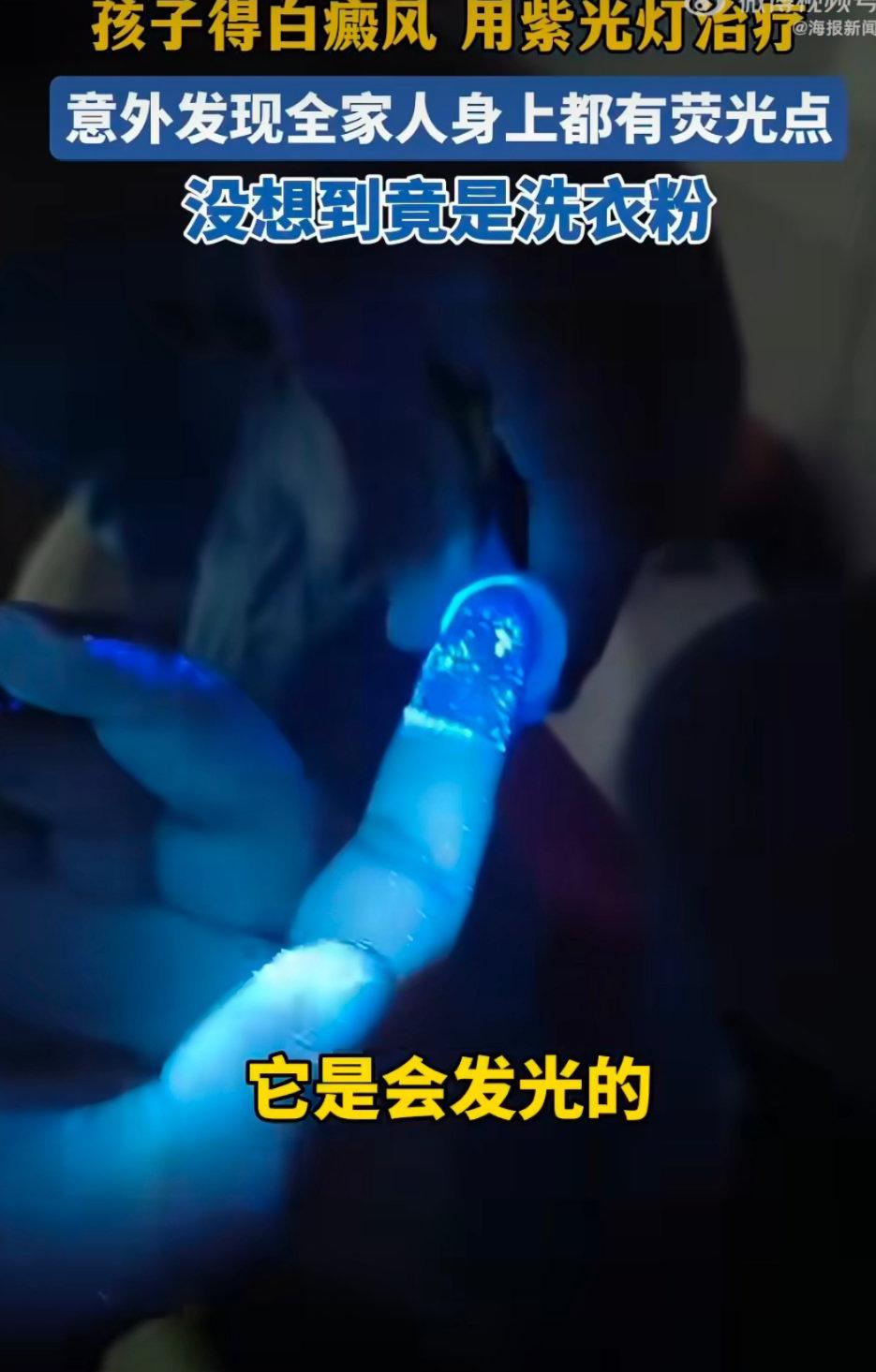 这事儿也太惊讶了吧？家长用紫光灯给孩子照白癜风，结果发现全家都在“发光”，最