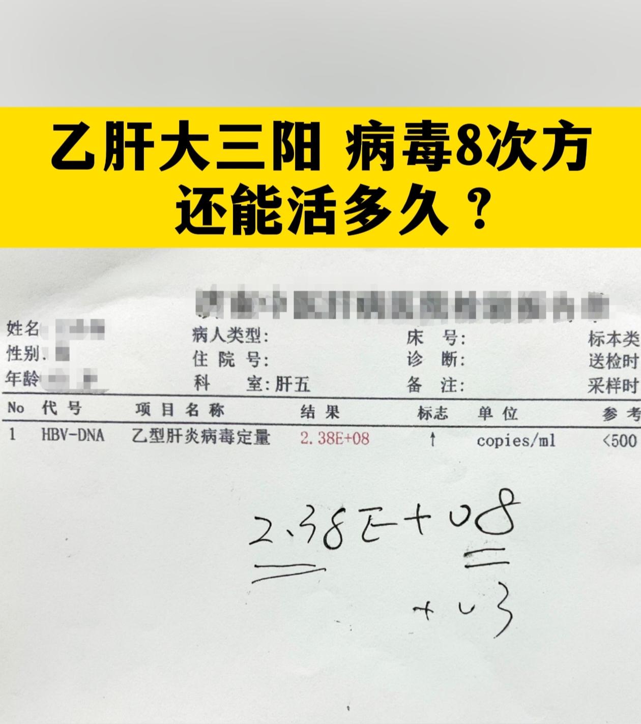 这是上午接诊的一位31岁的乙肝小伙，检查病毒量2.38*10的8次方...