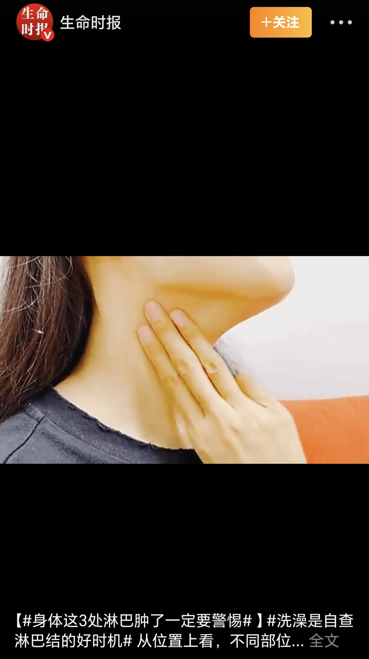 50岁的王女士洗澡时摸到颈部一个1厘米无痛小疙瘩，一直当炎症处理，两三个月后疙瘩变多变大，最终竟被确