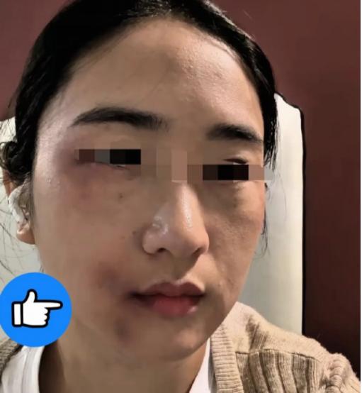 女子被丈夫殴打，其弟弟知晓此事后，取来家中一根钢管奔赴姐姐住处。丈夫将门打开，弟
