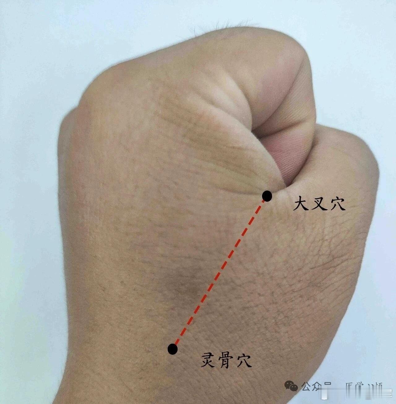 温阳补气，通调全身气血，大叉穴大叉穴源自董氏奇穴位置：在虎口，食指与拇指中间赤