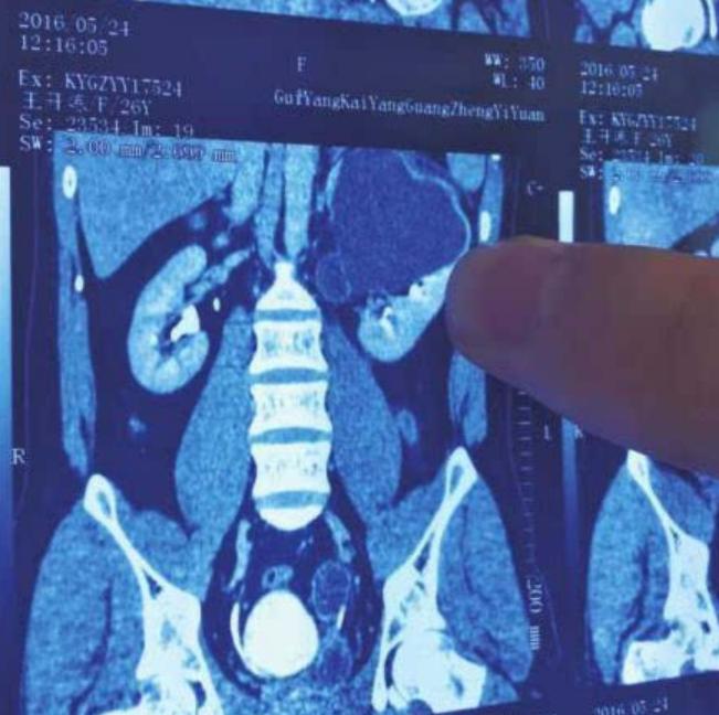 力气特别大，身体相当好。2016年5月，贵州开阳县的王开炼疼得站不起来。