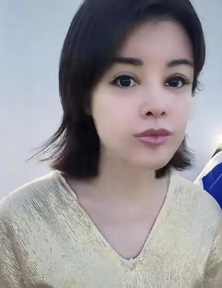 于文红又动她的脸了，粉丝说越整越难看。之前很多人说于文红是大小眼，一只眼大，一