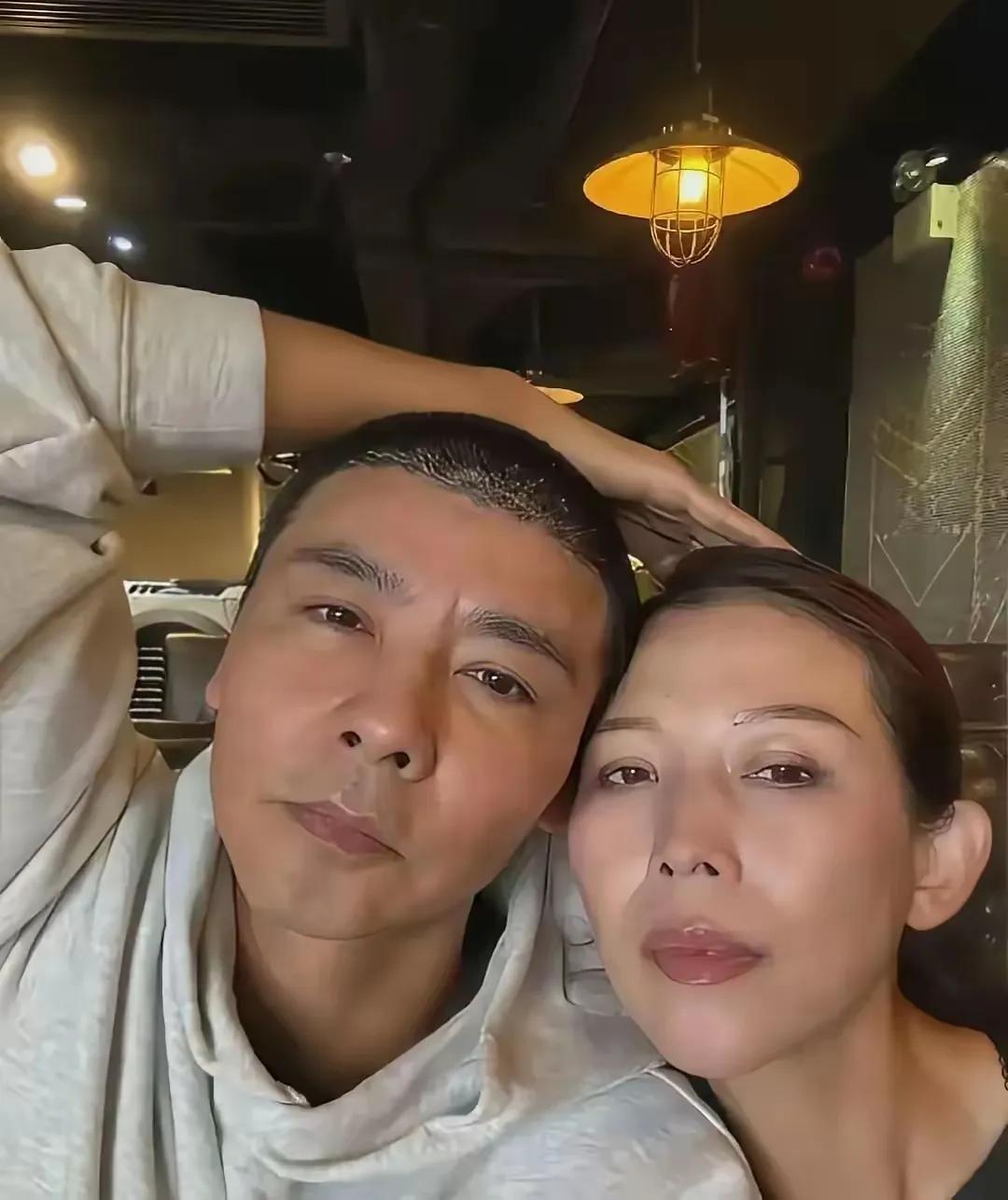 张晋：头发出了大问题！一直觉得张晋头发还算茂盛，电影里打戏又帅又飒，生活里也