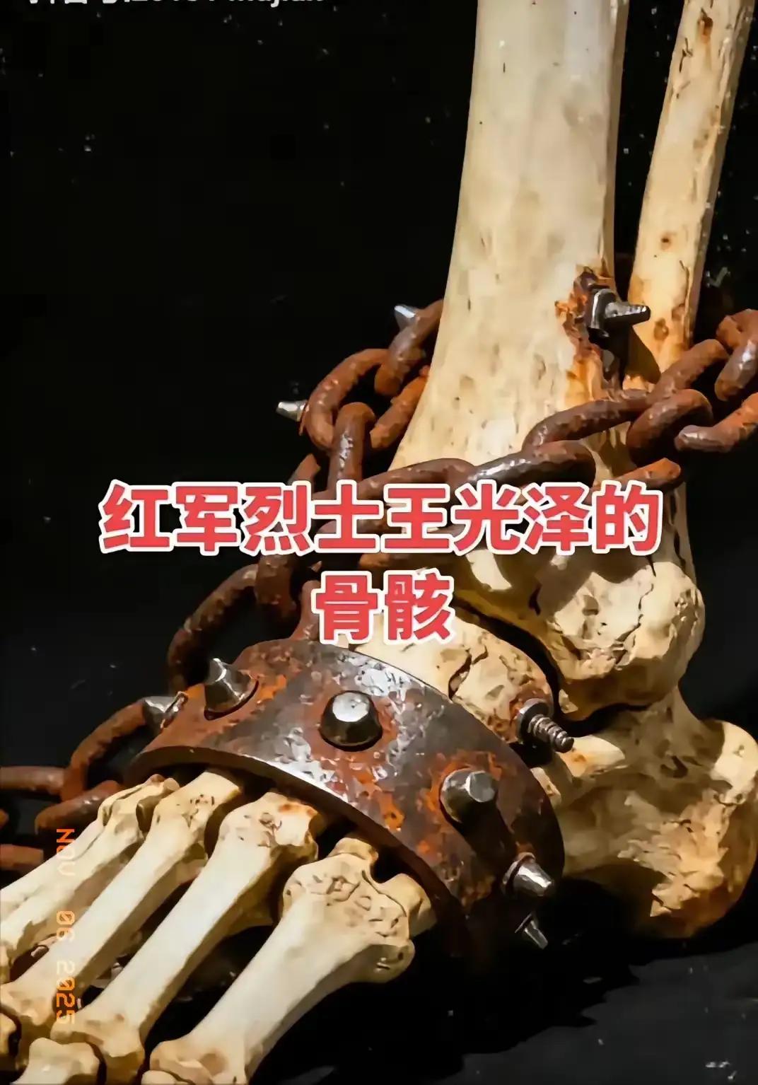 挖出来的时候，所有人都傻了。一副骸骨，脚上锁着7公斤的铁链。这不是重点，重点是