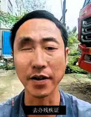 一只眼睛没了，去办残疾证，工作人员说办不了，因为你另一只眼好使，不影响正常生活。