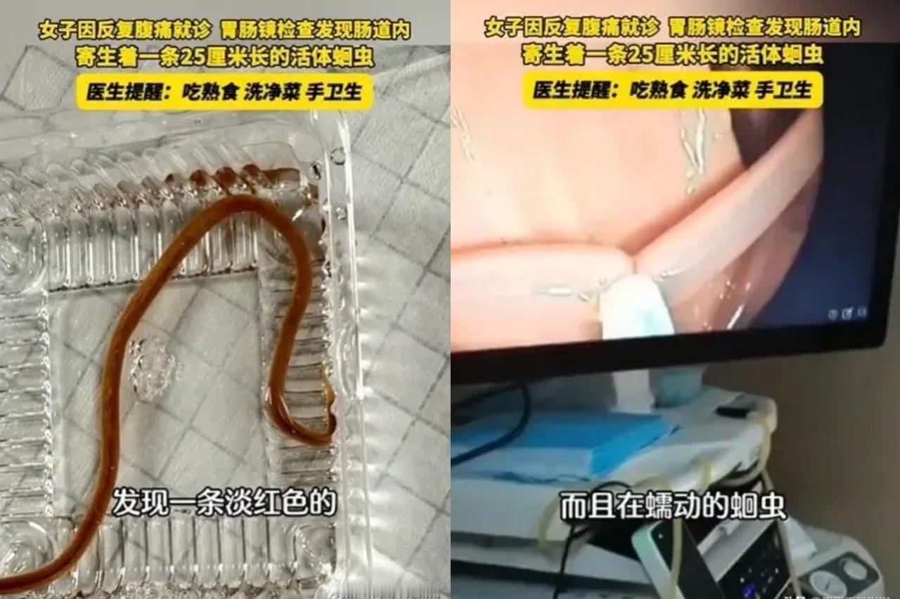 太可怕了浙江金华这位大姐的经历，看完我鸡皮疙瘩都起来了！40多岁腹痛以为是