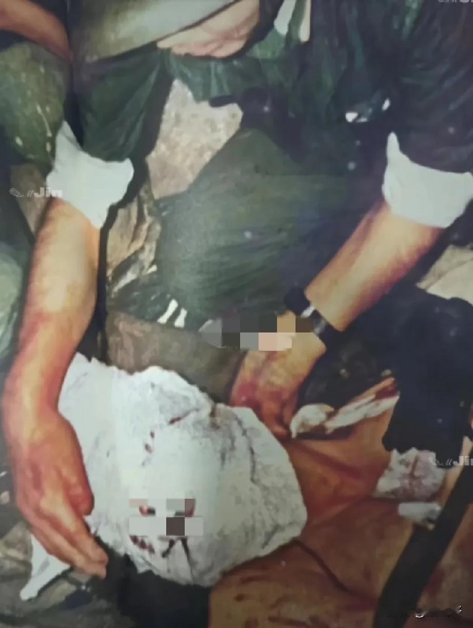 这是一名战士牺牲后，战友们小心翼翼地将其转运回后方的场景。1987年，我军对越